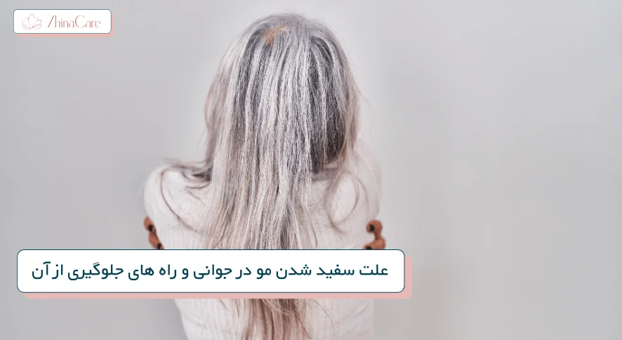 علت سفید شدن مو