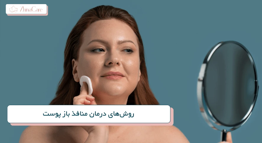 روش‌های درمان منافذ باز پوست